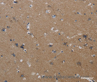 Immunohistochemistry of paraffin-embedded Human brain tissue using PIK3CG Polyclonal Antibody at dilution 1:40