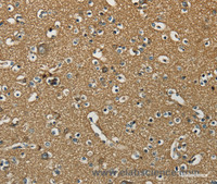 Immunohistochemistry of paraffin-embedded Human brain using NEMF Polyclonal Antibody at dilution of 1:30