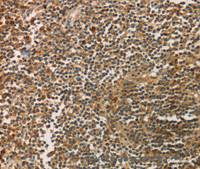 Immunohistochemistry of paraffin-embedded Human tonsil using SIGLEC15 Polyclonal Antibody at dilution of 1:35