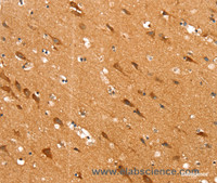 Immunohistochemistry of paraffin-embedded Human brain tissue using SLC25A12 Polyclonal Antibody at dilution 1:30