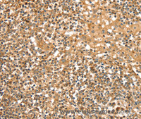 Immunohistochemistry of paraffin-embedded Human tonsil tissue using SLC8A3 Polyclonal Antibody at dilution 1:35