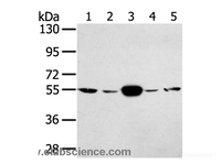 Western Blot analysis of Hela and K562 cell, Human fetal muscle tissue, A375 and hepg2 cell using TRIM35 Polyclonal Antibody at dilution of 1:400