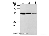 Western Blot analysis of Human thyroid and esophagus cancer, Human normal rectum tissue using TMPRSS11F Polyclonal Antibody at dilution of 1:500