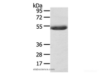 Western Blot analysis of Mouse plasma tissue using AGPAT6 Polyclonal Antibody at dilution of 1:400