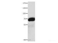 Western Blot analysis of Human liver cancer tissue using AFP Polyclonal Antibody at dilution of 1:1000