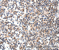 Immunohistochemistry of paraffin-embedded Human tonsil using AFP Polyclonal Antibody at dilution of 1:60