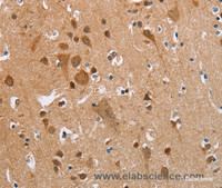 Immunohistochemistry of paraffin-embedded Human brain using CK-13 Polyclonal Antibody at dilution of 1:35