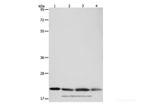 Western Blot analysis of Human brain malignant glioma tissue, MCF7, Raji and Lovo cell using BAX Polyclonal Antibody at dilution of 1:300