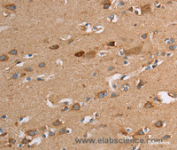 Immunohistochemistry of paraffin-embedded Human brain tissue using TLR8 Polyclonal Antibody at dilution 1:30