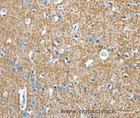 Immunohistochemistry of paraffin-embedded Human brain tissue using Amphiphysin II Polyclonal Antibody at dilution 1:30