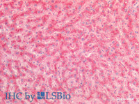 Immunohistochemistry of paraffin-embedded Human Liver using Cathepsin B Polyclonal Antibody at dilution of 1:100 (Elabscience® Product Detected by Lifespan) .