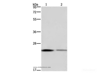 Western Blot analysis of Hela and HT-29 cell using EMC8 Polyclonal Antibody at dilution of 1:650
