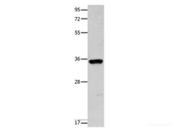 Western Blot analysis of Mouse brain tissue using COX11 Polyclonal Antibody at dilution of 1:600
