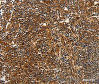 Immunohistochemistry of paraffin-embedded Human tonsil tissue using CNNM3 Polyclonal Antibody at dilution 1:40