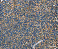 Immunohistochemistry of paraffin-embedded Human tonsil tissue using GRB7 Polyclonal Antibody at dilution 1:40