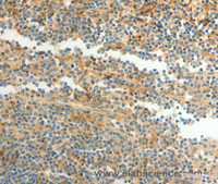 Immunohistochemistry of paraffin-embedded Human tonsil using CFHR1 Polyclonal Antibody at dilution of 1:40