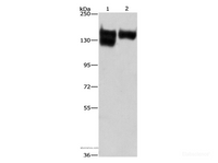 Western Blot analysis of A172 cell and Human leiomyosarcoma tissue using ITGB1 Polyclonal Antibody at dilution of 1:287.5