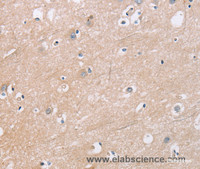 Immunohistochemistry of paraffin-embedded Human brain tissue using KLK4 Polyclonal Antibody at dilution 1:40