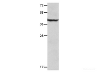 Western Blot analysis of Mouse lung tissue using SERPINB5 Polyclonal Antibody at dilution of 1:1000