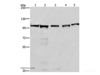 Western Blot analysis of 293T, A549, Raji, K562 and NIH/3T3 cell using MCM6 Polyclonal Antibody at dilution of 1:433.3