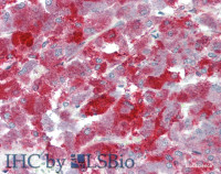 Immunohistochemistry of paraffin-embedded Human Adrenal using NRN1 Polyclonal Antibody at dilution of 1:70 (Elabscience® Product Detected by Lifespan) .