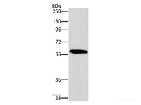 Western Blot analysis of A172 cell using PAK2 Polyclonal Antibody at dilution of 1:400