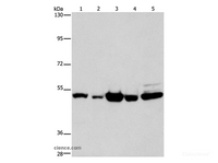 Western Blot analysis of Human bladder carcinoma and brain malignant glioma tissue, A172 cell, Human fetal brain tissue and hela cell using PDE4D Polyclonal Antibody at dilution of 1:450