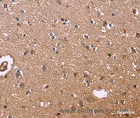 Immunohistochemistry of paraffin-embedded Human brain tissue using S100A13 Polyclonal Antibody at dilution 1:40