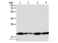 Western Blot analysis of Lncap, SKOV3, MCF7 and 293T cell using DIABLO Polyclonal Antibody at dilution of 1:800