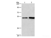 Western Blot analysis of Hela and Jurkat cell using SYT4 Polyclonal Antibody at dilution of 1:700