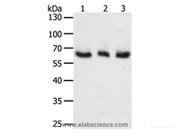 Western Blot analysis of A375, Hela and Jurkat cell using TYR Polyclonal Antibody at dilution of 1:400