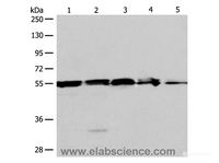 Western Blot analysis of A375, 293T cell and Mouse liver tissue, Jurkat cell and Human fetal kidney tissue using NAMPT Polyclonal Antibody at dilution of 1:700