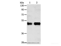 Western Blot analysis of Human liver cancer tissue and A549 cell using SERPINA5 Polyclonal Antibody at dilution of 1:750