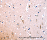 Immunohistochemistry of paraffin-embedded Human brain using ST2 Polyclonal Antibody at dilution of 1:70