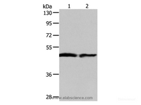 Western Blot analysis of Human fetal liver and liver cancer tissue using AADAC Polyclonal Antibody at dilution of 1:550