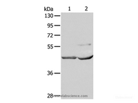 Western Blot analysis of Mouse kidney and heart tissue using NCEH1 Polyclonal Antibody at dilution of 1:1350