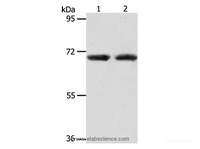 Western Blot analysis of Human liver cancer and fetal kidney tissue using ACOT11 Polyclonal Antibody at dilution of 1:650