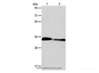 Western Blot analysis of Mouse kidney and Rat kidney tissue using ACY3 Polyclonal Antibody at dilution of 1:750