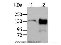 Western Blot analysis of Human liver cancer and normal liver tissue using AOX1 Polyclonal Antibody at dilution of 1:1000