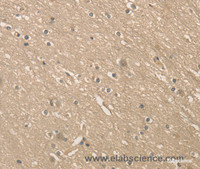 Immunohistochemistry of paraffin-embedded Human brain using ALDH8A1 Polyclonal Antibody at dilution of 1:40