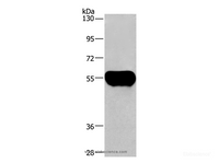 Western Blot analysis of Human plasma tissue using AHSG Polyclonal Antibody at dilution of 1:1350