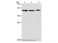 Western Blot analysis of PC3, Jurkat and Raji cell using APOBEC3G Polyclonal Antibody at dilution of 1:240