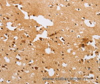 Immunohistochemistry of paraffin-embedded Human brain tissue using ACTR2 Polyclonal Antibody at dilution 1:40