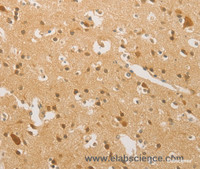 Immunohistochemistry of paraffin-embedded Human brain tissue using HIPK4 Polyclonal Antibody at dilution 1:30