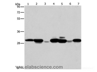 Western Blot analysis of Human placenta tissue and A549 cell, Mouse brain tissue and hepG2 cell, Raji cell and Human fetal liver tissue, hela cell using AK2 Polyclonal Antibody at dilution of 1:250