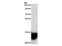 Western Blot analysis of Human fetal brain tissue using GPM6A Polyclonal Antibody at dilution of 1:1050