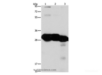 Western Blot analysis of Mouse liver and kidney tissue, Human fetal liver tissue using KHK Polyclonal Antibody at dilution of 1:1350