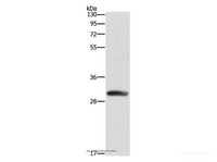 Western Blot analysis of Mouse heart tissue using DCK Polyclonal Antibody at dilution of 1:550