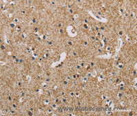 Immunohistochemistry of paraffin-embedded Human brain using PIP4K2A Polyclonal Antibody at dilution of 1:50