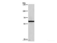 Western Blot analysis of A431 cell using TRIP4 Polyclonal Antibody at dilution of 1:400